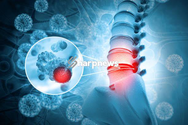 Every Man Should Avoid BONE Cancer By Taking Note Of These 6 Things