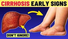 JUST-IN: Early Signs of Liver Enlargement You Should Never Ignore