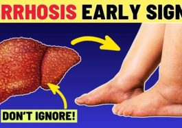 JUST-IN: Early Signs of Liver Enlargement You Should Never Ignore