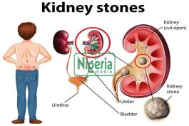 Foods You Should Stop Eating To Prevent Kidney Problems