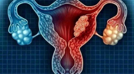 Uterine Cancer: Stay Away From These 4 (Four) Things To Avoid The Risk Of Being A Victim