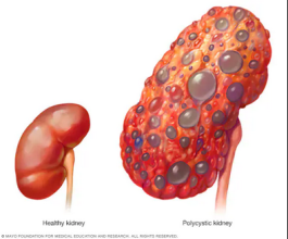 Eight Warning Signs of Kidney Damage You Should Never Ignore – Doctors Reveal What to Watch For