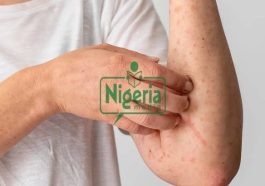 Six (6)Sign That You May Have HIV/AIDS But You Do Not Know