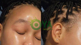 JUST IN: Easiest ways to get a youthful face and get rid of wrinkles