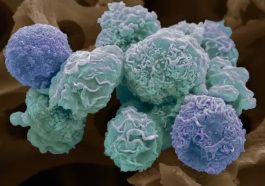 The Three Early Warning Sign Of Deadly Cancer That Can Appear 3 Years Before Diagnosis