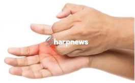 5 list of Health Meaning Of Itching Palms
