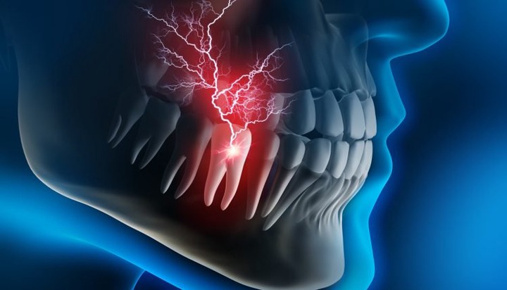 BREAKING: Killing Toothache in One Minute BREAKING: Killing Toothache in One Minute