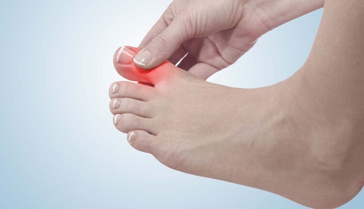 Rheumatologist: Never Ignore Big Toe Pain — It Can Be the First Sign Of Underlying Disease Rheumatologist: Never Ignore Big Toe Pain — It Can Be the First Sign Of Underlying Disease