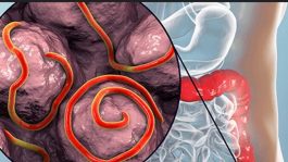 JUST IN: Foods That Naturally Remove Worms From the Stomach