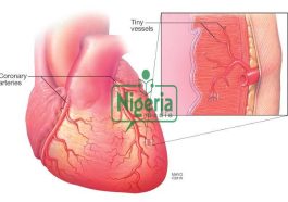 Five Symptoms That Appear Before The Heart Veins Get Blocked