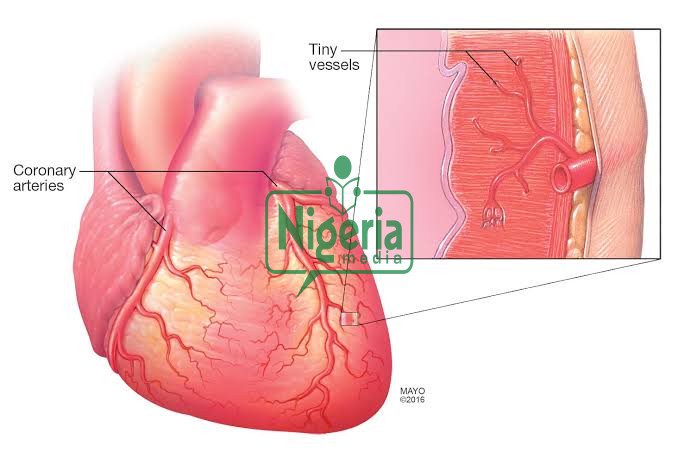 Five Symptoms That Appear Before The Heart Veins Get Blocked