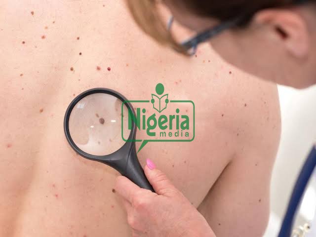 BREAKING: Early Warning Signs Of Cancer In Your Body You Should Not Play With BREAKING: Early Warning Signs Of Cancer In Your Body You Should Not Play With