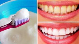Natural Following Home Remedies To Get Rid Of Yellow Teeth