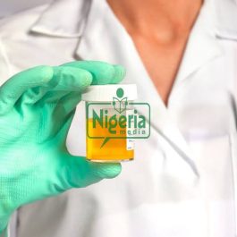 If Your Urine Always Foams, Here Are It’s 5 (Five) Possible Causes And Foods To Watch Out For