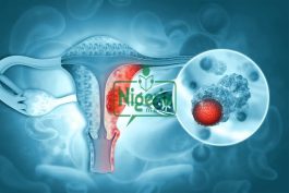 Uterine Cancer: Stay Away From These Four Things To Avoid The Risk Of Being A Victim