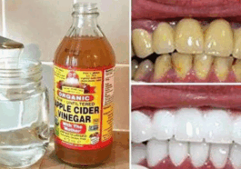 Here is what happens when you apply vinegar on your teeth