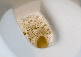 Cloudy Urine: Health Conditions That Can Make Your Urine Appear Cloudy