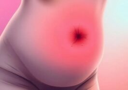 Dangerous Diseases That Can Cause a Woman’s Stomach to Be Significantly Swollen