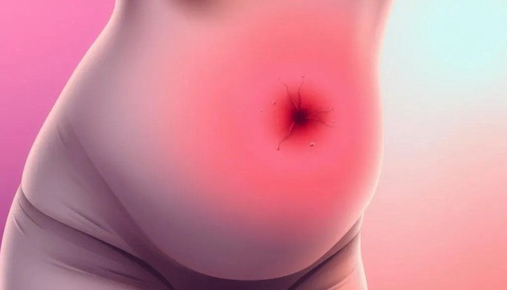 Dangerous Diseases That Can Cause a Woman’s Stomach to Be Significantly Swollen Dangerous Diseases That Can Cause a Woman’s Stomach to Be Significantly Swollen