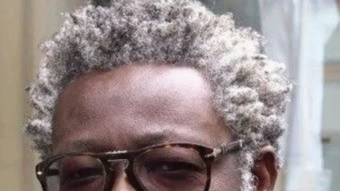 Say Goodbye To White Hair By Using These Natural Remedies (DETAILS) Say Goodbye To White Hair By Using These Natural Remedies (DETAILS)