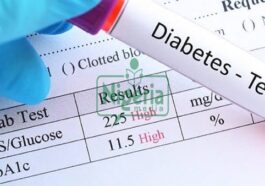 Stop Excess Intake of These 3 Three Types of Food to Avoid Diabetes