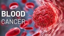 Blood Cancer Risks Accelerate When You Overconsume Here are 5 Items – Avoid Them to Increase Longevity