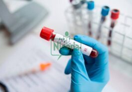 3 Three Dangerous Things That Could Affect Your Eyes If You Have HIV