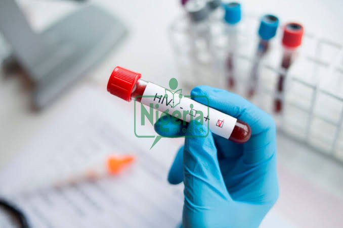 3 Three Dangerous Things That Could Affect Your Eyes If You Have HIV