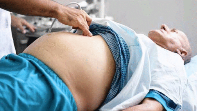 Liver Cancer Kills Fast, If You Value Your Life, Avoid Excess Intake Of These 3 Things