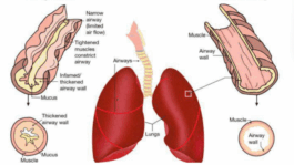 Important Traditional remedy for asthma, bronchitis, cough and lung diseases