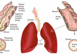 Important Traditional remedy for asthma, bronchitis, cough and lung diseases