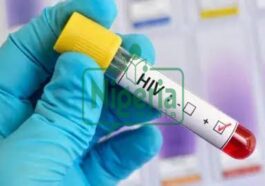 BREAKING NEWS: Foods That Helps To Boost immunity In HIV Patients