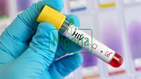 BREAKING NEWS: Foods That Helps To Boost immunity In HIV Patients BREAKING NEWS: Foods That Helps To Boost immunity In HIV Patients