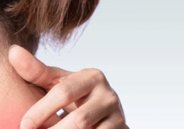 BREAKING NEWS: HIV Rash: You Might Have HIV If You See This Types Of Rash On Your Body