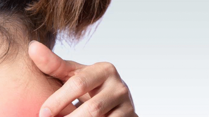 BREAKING NEWS: HIV Rash: You Might Have HIV If You See This Types Of Rash On Your Body