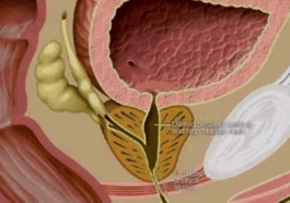 BREAKING: Urine Blockage Kills: Avoid These 5 Habits to Prevent Urine Blockages