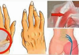 A simple and easy trick for removing arthritis, back pain and sciatica: works better than pills