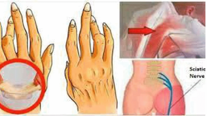 A simple and easy trick for removing arthritis, back pain and sciatica: works better than pills A simple and easy trick for removing arthritis, back pain and sciatica: works better than pills