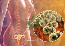 Three 3 Ways To Know If You Have STDs As A Lady