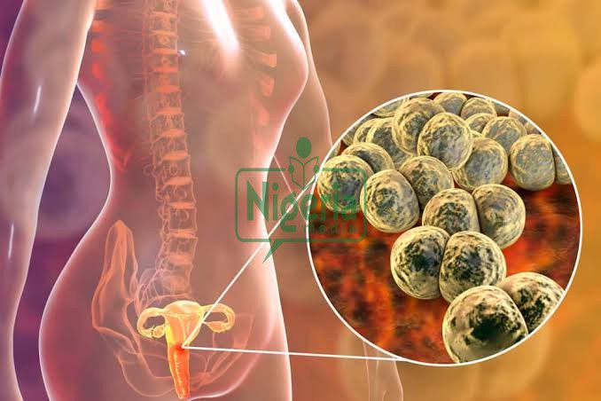 Three 3 Ways To Know If You Have STDs As A Lady