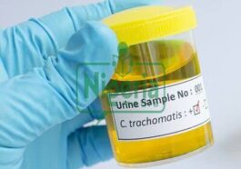 BREAKING NEWS: Signs Of Kidney Problems That May Be Noticeable In The Urine