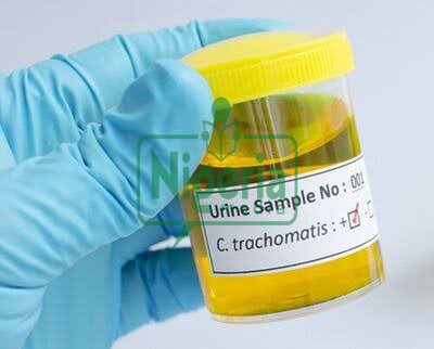 BREAKING NEWS: Signs Of Kidney Problems That May Be Noticeable In The Urine
