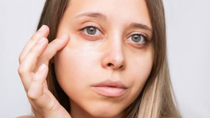 JUST-IN: Erase Eye Bags and Wrinkles Fast With This Secret Treatment JUST-IN: Erase Eye Bags and Wrinkles Fast With This Secret Treatment