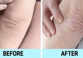 Six 6 Body Parts That Reveal a Person’s True Age