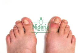 BREAKING: Ten 10 Warning Body Signs You Should Not Ignore