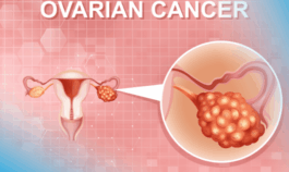 Symptoms Warning Signs of Ovarian Cancer That Many Women Overlook