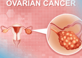 Symptoms Warning Signs of Ovarian Cancer That Many Women Overlook