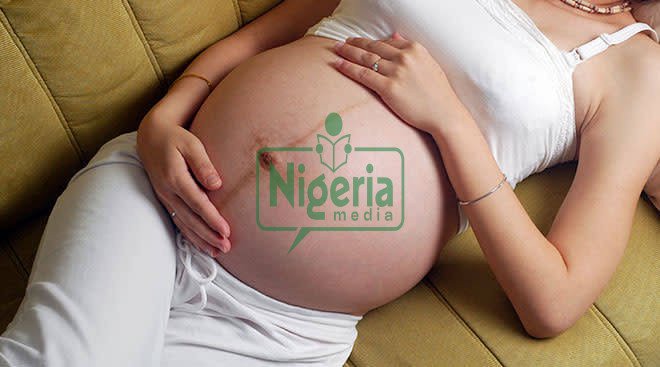 BREAKING: Reason Why Black Line Appear Along The Stomach Of Pregnant Women And It Functions