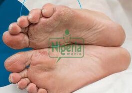 BREAKING NEWS: Four Symptoms Of Type 2 Diabetes Which Appear In Your Feet – What To Watch For
