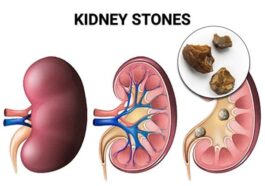 Cleanse Your Kidneys Naturally in Just 5 Minutes: A Simple Home Remedy That Works